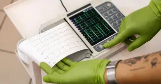 Elevated Lp(a) Signals Ongoing Heart Risk Despite Standard Therapy