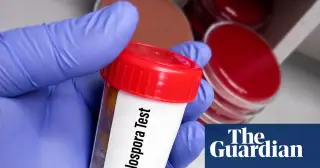 Budget Cuts Hamper U.S. Response to Record Cyclosporiasis Outbreak