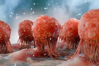 Ketogenic Diets Do Not Generalize: Tissue-Specific Cancer Effects Revealed