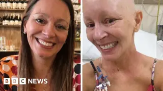 Contraceptive coil pain led to late-stage ovarian cancer diagnosis for Welsh woman