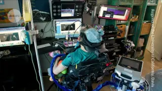 Home Brain Implant Restores Speech and Computer Use for ALS Patient