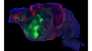 Human cortex organoids partially take over a mouse brain, with mixed results