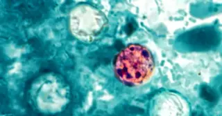 Michigan records two cyclosporiasis deaths amid lettuce-linked outbreak