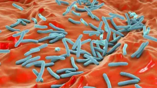 Possible MDR-TB exposure at CSU San Marcos campus and Sprinter prompts health alert