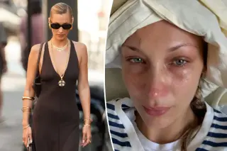 Bella Hadid breaks silence on Lyme-linked isolation and depression