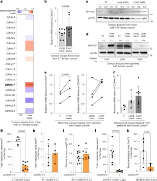 Liver palmitate fuels metastasis by dampening neutrophil attack through laminin-511 palmitoylation