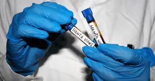 Cruise-Ship Andes Hantavirus: Why It Won’t Spark a Pandemic