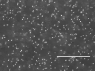 ISS Bioreactor Study Aims to Scale Up Stem Cell Therapies in Space
