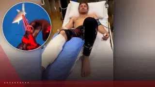 Diver Survives Fiji Shark Attack, Plans to Share Safety Lessons