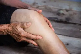 Knee Cartilage Shaving: New Study Questions Benefit, Warns of Harm