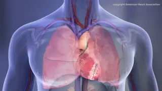 Gum Bacteria Linked to Heart Valve Calcification