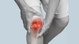 Large study ranks knee braces, hydrotherapy, and exercise as top relief for knee osteoarthritis