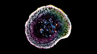 3D Map Reveals Killer T Cells’ Precise Cancer Attack