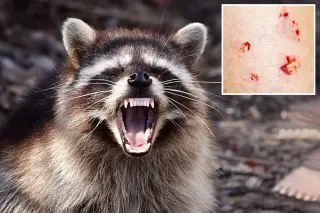 First Rabid Raccoon in LA County in 50 Years Triggers Public Health Alert