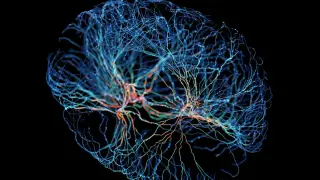 Brain Rewires in Response to Chronic Tinnitus, Study Finds