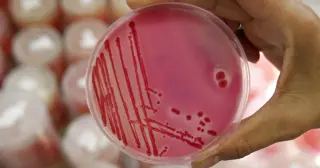 Colorado grapples with July surge in salmonella as investigators search for the source