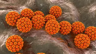 Infections Drive 2.3 Million New Cancers Globally, Study Finds