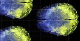 Low Vitamin C Levels Linked to Reduced Gray Matter and Brain Connectivity in Aging
