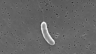 Florida records third Vibrio fatality as Gulf Coast infections rise
