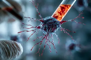 Blood Biomarker Signals Alzheimer’s Risk Years Before Symptoms