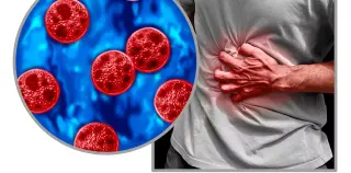 Why cyclosporiasis diarrhea can be explosive—and how your immune system decides its severity