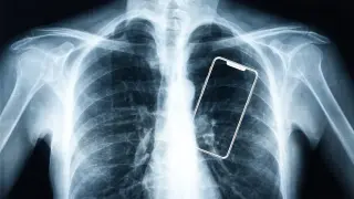 Screen Time Is Rewriting Our Bodies, Doctors Warn