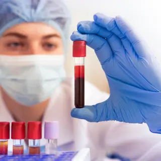 Early Blood Test Signals Alzheimer's Risk Long Before Scans