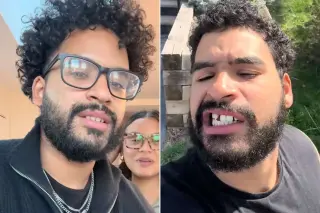 A Teacher’s Rebound: From Tooth Loss at 25 to a Rebuilt Smile