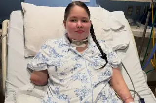Texas Teen’s Flu Battle Ends in Amputations, Now Facing a New Hurdle