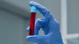 New Data Suggests Fasting Before Blood Tests Is Unnecessary for Most Routine Labs