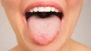 Study Links Oral Microbiome Diversity to Cognitive Processing Speed in Healthy Adults