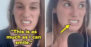 Hannah Berner's TMJ Botched Botox Sparks Internet Laughter