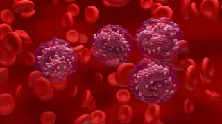 Phase 2 Trial Finds Daily Vitamin C May Extend Survival in Pre-Leukemia Patients