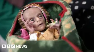 Yemen’s Collapsed Ceasefire Drives Newborn Twins to Starvation as Aid Crumbles