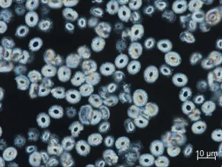 Ancient Coccoliths Reveal a Cooler Miocene North Atlantic Than Expected