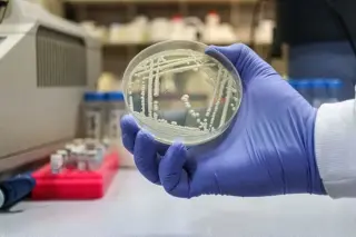 Kenyan Study Reveals Second Case of Pan-Resistant C. auris with Unique Genetic Mutations