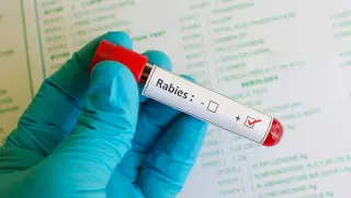SC Rabies Alert: Rabid raccoon and bat linked to two exposures