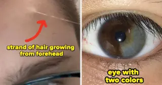 Close-Up Wonders: 38 Surprising Details Of The Human Body