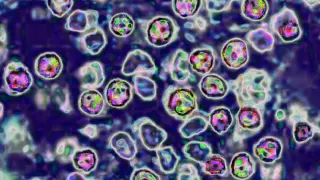 Domestic Travel Drives Five Measles Importations to Washington State