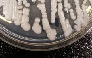 Drug-resistant Candida auris resurges nationwide, reaching Maryland