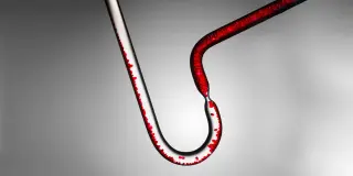 New Cholesterol Rules Tighten Targets and Start Early Prevention