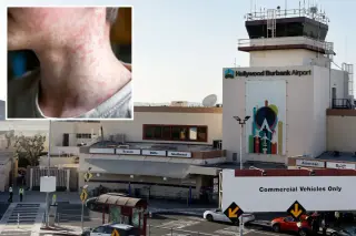 Measles exposure prompts health alert at Burbank Airport