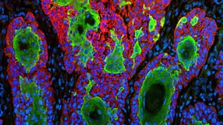 FDA Rejects Replimune’s Engineered Virus for Melanoma Again, Sparking Regulatory Debate