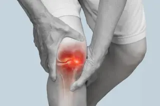 Arthritis Pain Lingers: Sleep, Mood, and Weight May Drive Symptoms