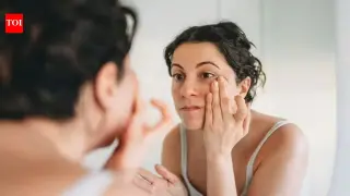 Doctors debunk 'ferritin face' trend, urging blood tests over mirror checks