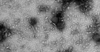 VIPR: An Ancient Viral Gene-Editing Defense Preceding CRISPR