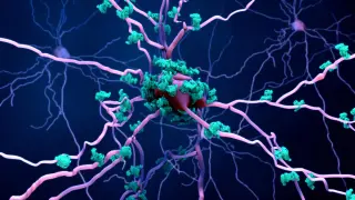 Karyoptosis: a nuclear-collapse death pathway linked to Alzheimer's and dementia