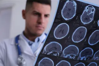 Two Drugs Spark Remyelination in MS Models, Hinting at Nerve Repair