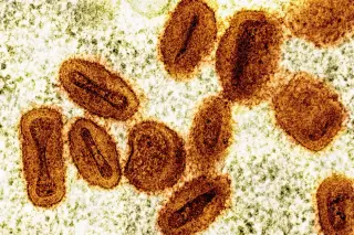 U.S. charges two scientists for importing deactivated mpox virus without authorization