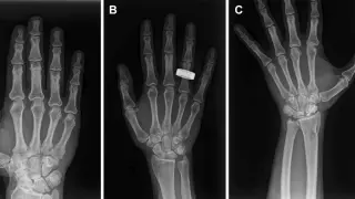 First In-Orbit X-Rays Spark a New Era in Space Medicine